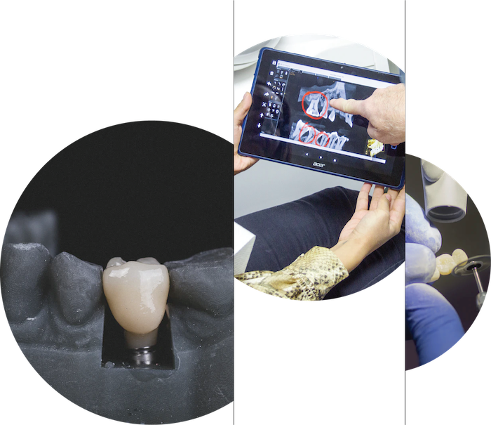 Especialidad en Periodoncia e Implantología | UAG